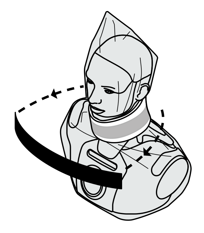 Remove loop strap